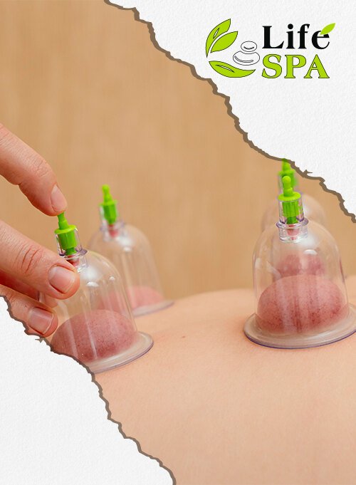 Cupping Masajı Lüleburgaz